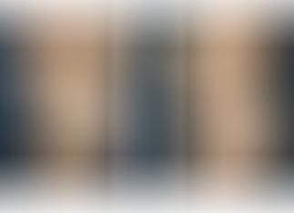 A collage of photos of a patient before & after a Body lift with the Lockwood technique.