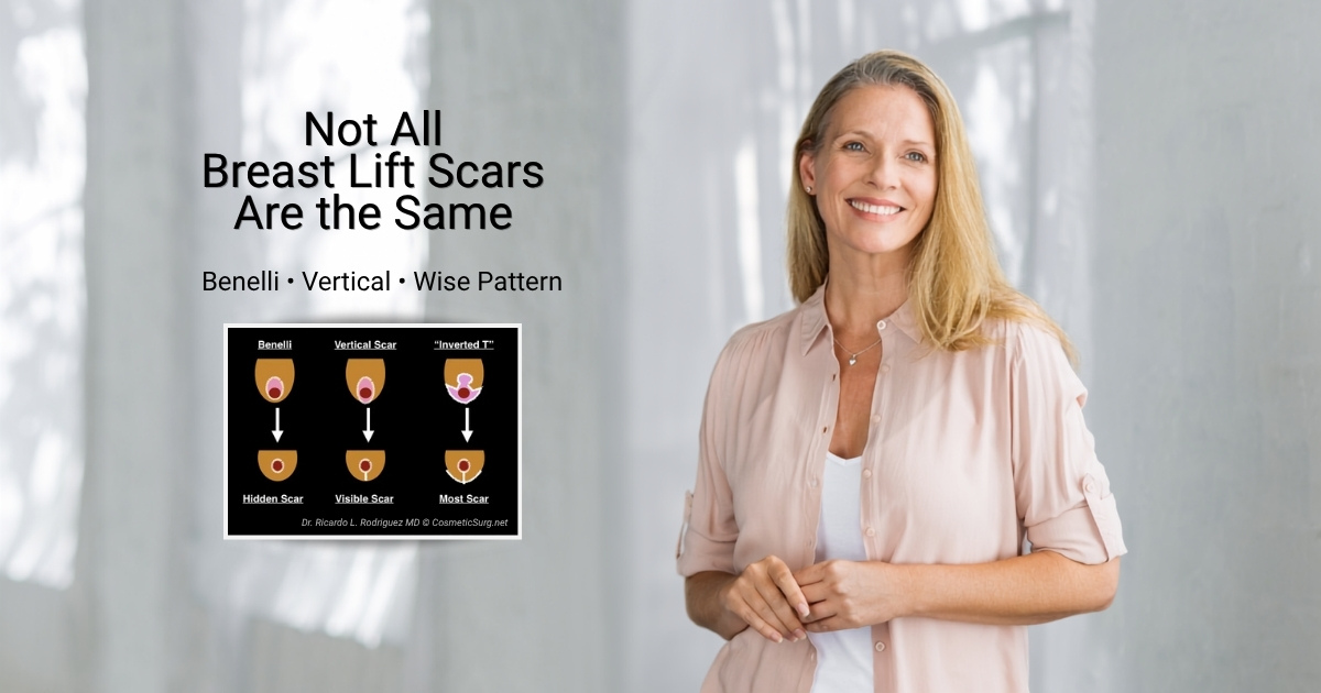 Smiling woman beside text reading “Not All Breast Lift Scars Are the Same” with an illustration comparing breast lift scar patterns.