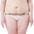 woman's torso with arrows marking standard tummy tuck incision with extended tummy tuck extension arrows