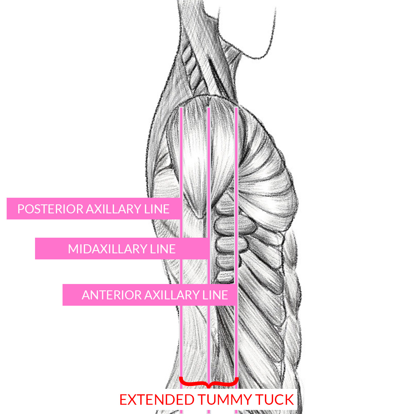 human anatomy sketch marking the posterior axillary line, the midaxillary line, and the posterior axillary line