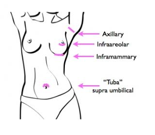 Types of Breasts Vector Images (over 410)
